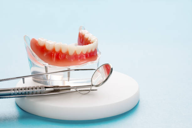 Full Mouth Reconstruction in Winthrop, MN